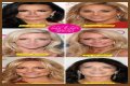 Botox, Implants & More! – Hollywood Life